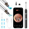 Ear Wax Removal, Ear Camera with Omnidirectional Tweezers, Otoscope with 1080P Camera, Ear Wax Removal Kit with 6 Ear Pick view 1