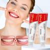 2 Pcs SP-6 Brightening Probiotic Toothpaste,Deep Cleaning Care Fresh Breath SP-6 Ultra Whitening Toothpaste. view 2