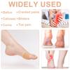 24pcs Toe Cushion Protectors Patches, Comfortable Adhesive Pads Lessen Pain Friction Adhesive Tape Anti-Slip Waterproof Foot Cushions Corn Remover Guards for Women Men Feet view 3