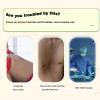 Pectus Excavatum Orthosis Brace,Pectus Excavatum Vacuum Bell - Pectus Excavatum Orthosis Brace,Chest Support,with Pressure Gauge,M view 2