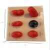 Silicone Stoma Model Set for Simulation, ostomy Care Practice, Demonstration, 6 Stomas view 2