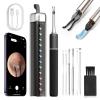 CozyZen Ear Wax Removal Tool S5 with 10 MP Camera Otoscope, Omnidirectional Tweezer, Crodless Earwax Remover Tool with 12 Ear Spoon, Wireless Ear Cleaner with Light for iOS & Android (Black) view 1