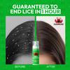Clearlice Treatment Kit for Kids & Adults Guaranteed to End Lice in 1 Hour, Extra Strength Treatment for Family to Remove Super Lice, Nits & Eggs - Includes 5oz Foam, Comb & Cap view 4