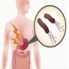 PCI H. Pylori Analysis - Non-Invasive Stool Test for Bacterial Infection Detection, Convenient & More Accurate Than Regular Home Tests - Testing Package Included for Reliable Diagnosis and Treatment view 2