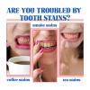 2PCS SP-6 Toothpaste, SP6 Probiotic Toothpaste, Fresh Breath, Deep Cleaning Care view 4