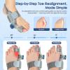 Bunion Corrector for Women Men Big Toe,Adjustable Knob Bunion Corrector for Bunion Relief,Bunion Fix with Bunion Silicone Pad,Suitable for Left and Right Feet(1PCS) view 2