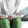 Luarisgur Dachshund Arm Cast Cover Elastic Sleeve Protectors for Arms Soft Fabric Arm Cast Cover Removable Washable Cast Scratch Sleeves Soft Wrist Cast Cover Medium view 2