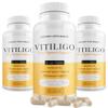 Dermawonder Vitiligo Capsules 60 Count | Effective Vitiligo Supplement | Reduce White Spots and Improve Skin Pigmentation Support | Suitable for All Skin | Natural Solution for White Spots on (3) view 1