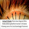 SteamGoggle-Powerful New Dry Eye/Stye Treatment, View Phone/TV During Moist Heat Treatment, Effectively Unclogs Oil Glands for Relief from MGD/Blepharitis/Styes/Chalazions/Irritated Eyes view 4