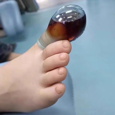 10pcs Finger Soaking Set Nail Protector Cap for Injured Fingernails Waterproof Finger and Toe Caps