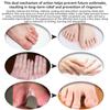 Heat rash cream, eczema, Hand and foot treatment, tinea versicolor, itchy feet, butt, psoriasis, scalp dandruff, bee stings, bites, boiling cysts, armpits, adults, children view 4