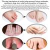 EOIK Heat rash cream, eczema, Hand and foot treatment, tinea versicolor, itchy feet, butt, psoriasis, scalp dandruff, bee stings, bites, boiling cysts, armpits, adults, children view 4