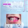 Teckolign Dental Plaque Disclosing Agent, Plague Display Cotton Swab(not Tablets) Indicator, for Kids & Adults, Shows Plaque,Helps Teach Brushing Habits, Dental Care Kits, 20 Count in 1 Pack view 2