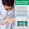 Hermon Psoriasis Eczema Relief Cream: Maximum Strength for Psoriasis Eczema - Relieve Symptom of Resistant Effective for Seborrheic Dermatitis Folliculitis 100m 3.4 Fl Oz (Pack of 1) view 4