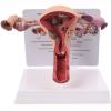 Female Uterus Ovary Model, Pathology Model of Human Female Uterus Ovary Disease Dissection Biology Teaching Aid Anatomy Lesion Uterus view 2