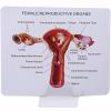 Female Uterus Ovary Model, Pathology Model of Human Female Uterus Ovary Disease Dissection Biology Teaching Aid Anatomy Lesion Uterus view 4