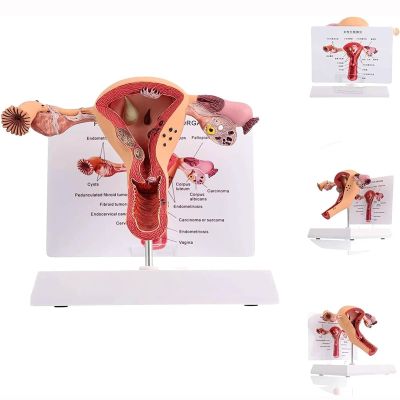 3D Human Uterus Model Human Anatomy Anatomy of The Female Reproductive System Replica Anatomy for Physicians Educational Tool
