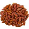 CLEAR CREEK Certified Glyphosate Residue Free Kidney Beans | 1 LB | Non-GMO | Vegan | Non-Irradiated (Will Sprout) | Kosher | Vegan | Grown Pacific Northwest view 2