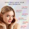 Red Light Therapy for Face, Portable LED Face Mask Light Therapy with Remote, 660nm & 850nm Near Infrared Red Light Mask with Timing Function, Reduced Wrinkles, Rejuvenating, Anti-Aging, at Home view 2