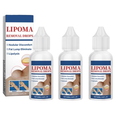 TQIUH Herbal Lipoma Removal Drops,Lipoma Removal,Lipoma Removal Cream,Creating Perfect Skin(3PCS)
