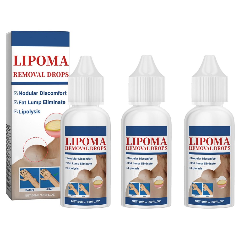 TQIUH Herbal Lipoma Removal Drops,Lipoma Removal,Lipoma Removal Cream,Creating Perfect Skin(3PCS)