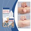TQIUH Herbal Lipoma Removal Drops,Lipoma Removal,Lipoma Removal Cream,Creating Perfect Skin(3PCS) view 2
