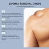 TQIUH Herbal Lipoma Removal Drops,Lipoma Removal,Lipoma Removal Cream,Creating Perfect Skin(3PCS) view 4