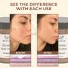 BELLA LIZ Eczema Cream 8oz - Soothing Relief for Dry, Irritated Skin, Hydrating & Healing Formula, All-Natural Ingredients, Perfect for Sensitive Skin & Daily Moisturizing view 3