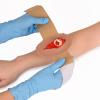 MedEduQuest Wound Packing Trainer, Strap-On Open Fracture, Second Degree view 2