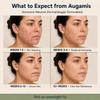 Augamis Hormonal Acne Treatment for Women DIM-Free Clear Skin Supplement for Face & Body - Supports Nodular & Cystic Acne Relief and Rosacea Care for Teens & Adults (60 Pills, 485mg) view 2