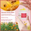 AEROMAXX Max Strength Bee Venom Cream, Natural Organic Soothing Treatment for Psoriasis, Rash, Jock Itch, Stubborn Ringworm, Itchy, Dry Skin - All Body Skin for Children & Adults view 2