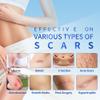 Safirst Silicone Scar Sheets 1.6"x59" Roll-1.5M Scars Removal Treatment Medical Grade Silicone Scar Tape for Skin Resuable Strip for Tummy Tuck,Incision,Keloid,C-Section,Burn,Acne Scars view 3