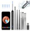 SEDLAV Ear Wax Removal Tool Camera, Earwax Removal Kit with Camera, Earwax Removal Tools, Earwax Camera 1080p, Ear Wax Removal Tool Camera (4) view 1