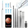 SEDLAV Ear Wax Removal Tool Camera, Earwax Removal Kit with Camera, Earwax Removal Tools, Earwax Camera 1080p, Ear Wax Removal Tool Camera (4) view 2