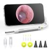 Digital Otoscope, Video Ear Scope Camera Compatible with iPhone/Android view 1