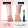 Facn Professional Callus Shaver Remover with 50 Blades, Pedicure Razor for Feet & Hands, Foot Razor for Callus Removal, Callus Blade Remover, Corn Shaver, Surgical Grade Premium Stainless Steel Tool view 3