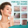 Silicone Scar Sheets, Silicone Scar Tape(1.6"x 59" Roll-1.5M), Scar Tape for Surgical Scars, Silicone Tape for Scars, Scar Sheets for Surgical Scars, C-Section, Tummy Tuck and Keloid view 3