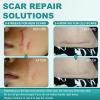 Silicone Scar Sheets, Silicone Scar Tape(1.6"x 59" Roll-1.5M), Scar Tape for Surgical Scars, Silicone Tape for Scars, Scar Sheets for Surgical Scars, C-Section, Tummy Tuck and Keloid view 4