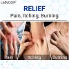 LMNOOP Eczema Cream, Maximum Strength Treatment Ointment for Dermatitis, Rash, Psoriasis, Urticaria, Tinea Pedis, Fungal Infection, Anti-Itch, Relief for Sensitive & Irritated Skin, 1.76oz 2PCS view 2