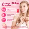 Mchokuu L-Lysine 1000mg Gummies, Chewable Lysine Supplement for Adults & Kids Immune Support, Essential Amino Acid, Vegetarian, Non-GMO, Sugar-Free, Gluten Free, Strawberry Flavor, 60 Counts view 3