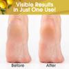 DeEnti Callus Remover for Feet, Extra Strength Foot Callus Remover Gel, 16oz Salon Grade Home Pedicure Supplies for Dry Skin, Cracked Heel, Professional Strength Foot Care, Lemon view 3