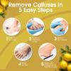 DeEnti Callus Remover for Feet, Extra Strength Foot Callus Remover Gel, 16oz Salon Grade Home Pedicure Supplies for Dry Skin, Cracked Heel, Professional Strength Foot Care, Lemon view 4