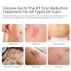 100% Silicone Scar Gel 2 Pack: 2 x 1.06oz Tubes for Surgical Scars, C-Section, Acne, Keloids, Burns, Stretch Marks Advanced Scar Treatment for Old & New Scars view 2