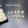 1 Box False Teeth Crown Repair Kit Dental Anterior Veneers Fake Tooth Cap Crown with Thermal Beads for Fixing or DIY view 2