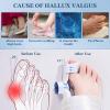 Bunion Corrector for Women Men Big Toe,Breathable Treatmedy Bunion Fix,Adjustable Knob Bunion Relief Orthopedic Toe Straightener with Bunion Silicone Pad,Suitable for Left and Right Feet(1PCS) view 2
