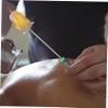 MUCKLILY Cupping Accessory Ignition Tool for Cupping Massaging Igniter Fire Rod Replaceable Cotton Ball Head Safety Handle view 4