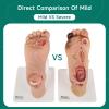 Ultrassist Diabetic Foot Ulcer Model Set - Anatomical Accuracy for Mild & Severe Stage Pathology Study - Medical Training Tool for Healthcare Professionals view 2