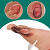 Ultrassist Diabetic Foot Ulcer Model Set - Anatomical Accuracy for Mild & Severe Stage Pathology Study - Medical Training Tool for Healthcare Professionals view 3