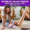 FOLEX Professional Carpet Spot Remover, 34oz view 3
