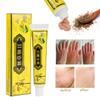 BaiSntg 5Pcs Chinese Herbal Eczema Psoriasis Creams Dermatitis and Eczema Pruritus Psoriasis Ointment view 4